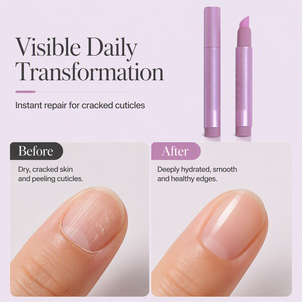 💅 Buy 2 Get 1 FREE | Portable Nail Care Essence Pen